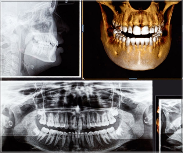Radiologia Odontoiatrica